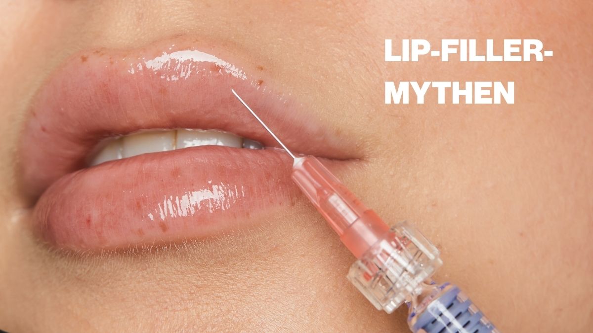 Die häufigsten Lip-Filler-Mythen im Check
